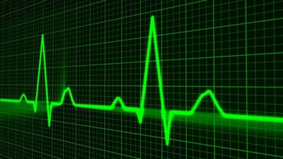 Pourquoi le Core Web Vitals de Google devient-il un critère SEO incontournable ?